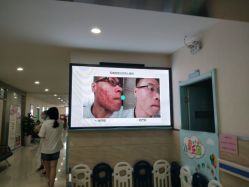 点击看大图 -成都军建医院·疤痕诊疗中心