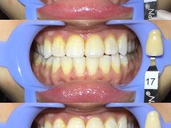 -齐玉齿科JADENTAL