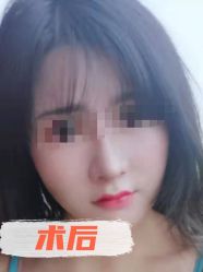 -素美医疗美容·西南眼鼻整形·修复基地