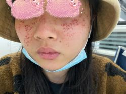 -深圳阳光医疗美容医院·旗舰店