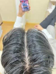 -菩叶脱发白发中心