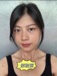-广东韩妃整形外科医院
