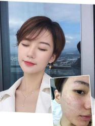 点击看大图 -纯粹医美