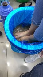 点击看大图 -德哥灰指甲脚气甲沟炎跖疣护理