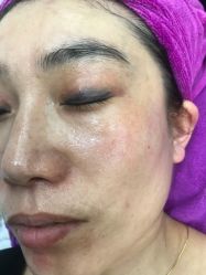 -爱美丽科技美肤中心