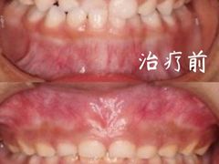 -精德口腔·种植修复·儿牙中心(财富中心店)