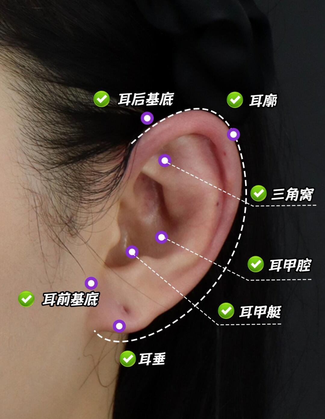 外耳门位于颧骨图片