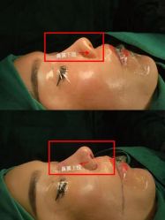 -北京米扬丽格医疗美容·联合丽格鼻整形中心