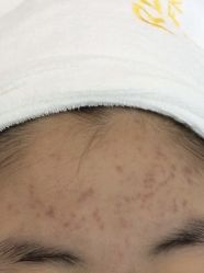 -蕾特恩专业祛痘·皮肤管理