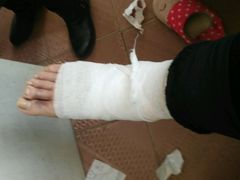 -大韩庄韩氏祖传正骨