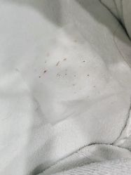 -痘瑞仕·专业祛痘国际连锁