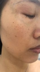 体验前-南宁华美医疗美容医院