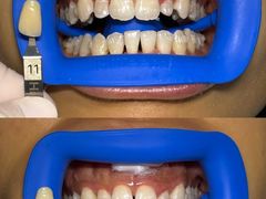 -极光口腔·矫正种植修复(锦江院区)