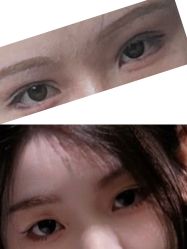 -洁铭新加坡医美