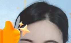 -大麦微针植发丨全国连锁