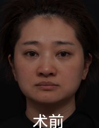 -苏州维多利亚美容医院