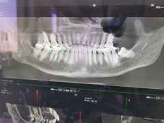 -Dr.Z dental仁康种植矫正中心