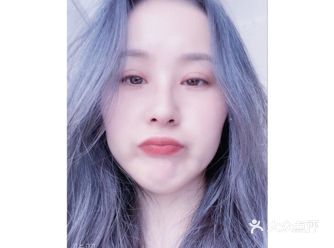 全切双眼皮+开眼角60天了