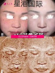 -星港国际·Skin皮肤专研·皮肤管理