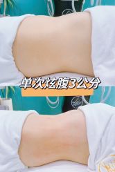 -Lily纤美·科技减脂中心