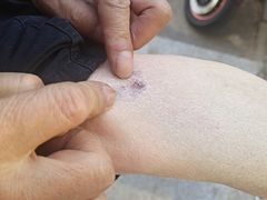 -首都医科大学附属北京潞河医院