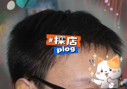 -大麦微针植发全国连锁