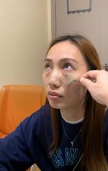 -广州健丽·去眼袋医疗美容机构