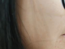点击看大图 -广州美莱医疗美容医院