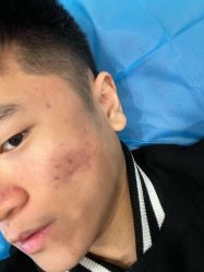 体验前-郑荃丽格医疗美容