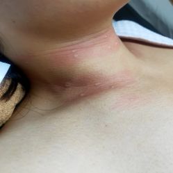 -清疣美疣·痣·斑净肤中心