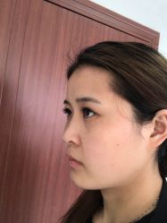 体验后-南京康美美容医院·旗舰店