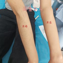 体验前-木兰清颜医疗美容