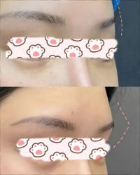 -素美医疗美容·西南眼鼻整形·修复基地