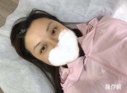 点击看大图 -西施无菌半永久纹绣眉眼影唇轻增发纹发际线
