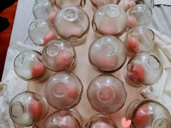 -裕和堂中医推拿艾灸(太古汇臻品店)