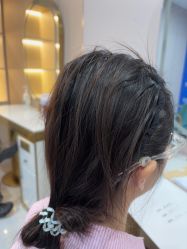 -碧莲盛不剃发植发