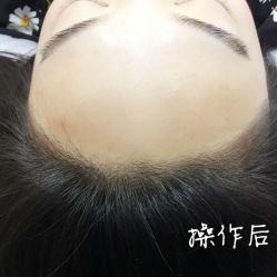 -西施无菌半永久纹绣眉眼影唇轻增发纹发际线