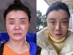 -加减美医美连锁品牌