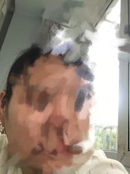 点击看大图 -肤原祛痘修肤中心