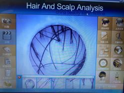 -黑奥秘脱发白发中心