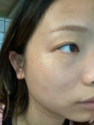 体验后-杭州米兰柏羽医疗美容医院