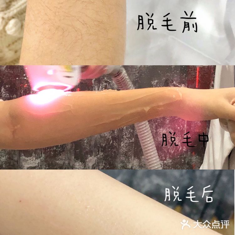 告别猕猴桃🥝女孩