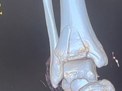 -广州中医药大学深圳医院(福田)