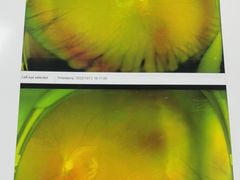 -武汉大学附属爱尔眼科医院(湖北总院)