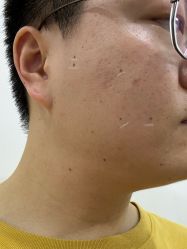 -成都西区医院整形美容