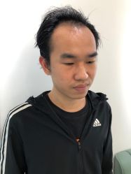 -发饰美男士增发补发假发定制店