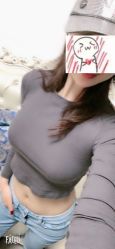 点击看大图 体验后-广州美莱医疗美容医院