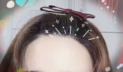 -大麦微针植发全国连锁