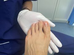 -Andrew指甲专科灰指甲·甲沟炎矫正·3D步态矫形鞋垫定制(上海法华镇路旗舰店)