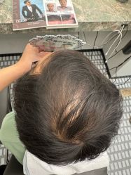-唐风采假发补发定制